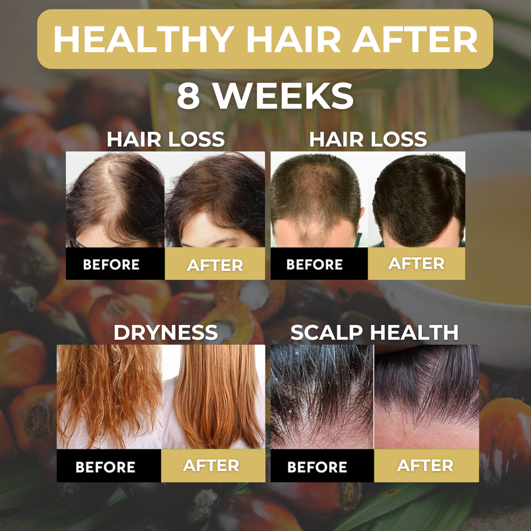 Yardlie Hair Color Gel 200ML + Elizora London Batana Oil